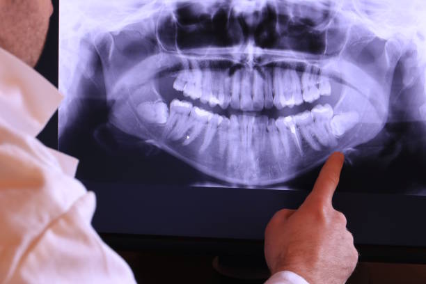 Best Root Canal Emergency Dentist  in New Orleans, LA
