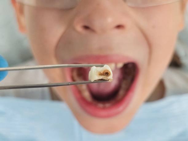 Best Cracked Tooth Emergency Dentist  in New Orleans, LA
