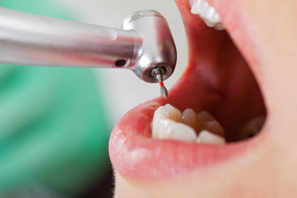 Best Tooth Pain Emergency Relief  in New Orleans, LA